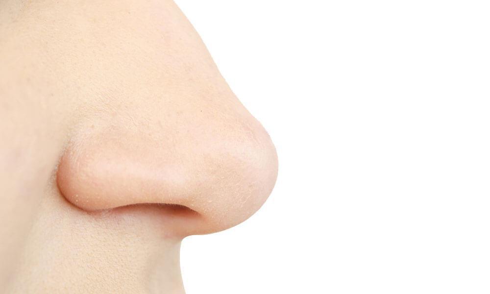 Rhinoplasty Los Angeles